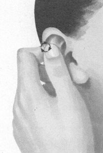 近视按摩部位图解