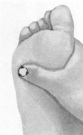 胃肠炎按摩部位图解