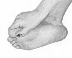 肩周炎按摩部位图解