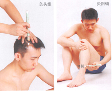 头痛艾灸哪个部位图解