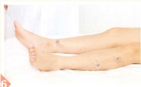 瘦身降脂拔罐部位图解