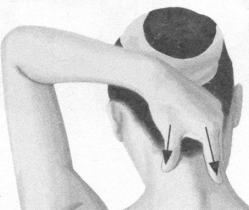 颈椎病按摩部位图解