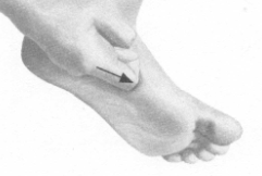 糖尿病按摩部位图解