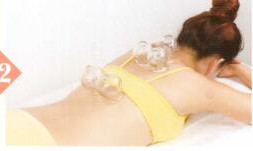 麦粒肿拔罐部位图解