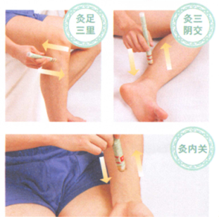 动脉粥样硬化艾灸哪个部位图解