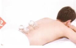 膀胱炎拔罐部位图解