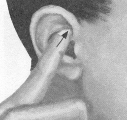 咳喘病按摩部位图解