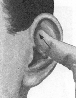 耳鸣-耳痛按摩部位图解