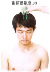 足跟痛刮痧部位图解