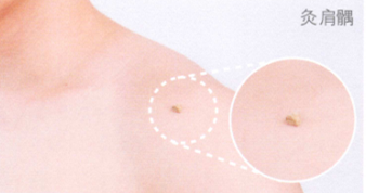 中风后遗症艾灸哪个部位图解