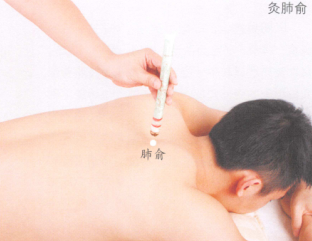 多汗症艾灸哪个部位图解