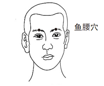 针灸穴位治疗各类痛证