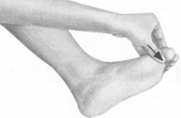 颈椎病按摩部位图解