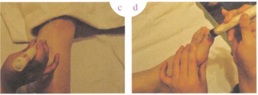 白带病艾灸哪个部位图解