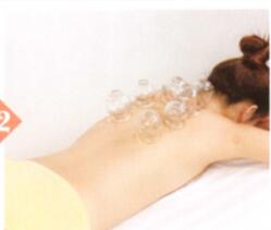 支气管炎拔罐部位图解