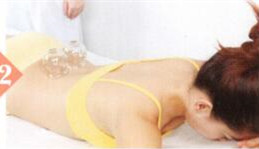 小腿抽筋拔罐部位图解