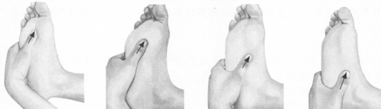 经前期综合征按摩部位图解