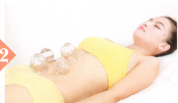 急性肠炎拔罐部位图解