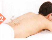 尿道炎拔罐部位图解