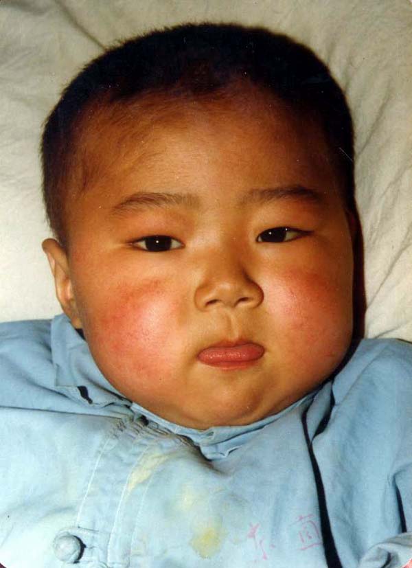 中医望色之面色红黄，吐弄红舌