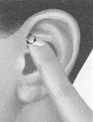 糖尿病按摩部位图解