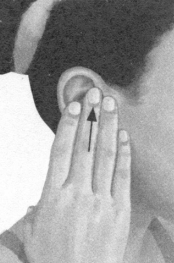 肩周炎按摩部位图解