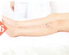 慢性胃炎拔罐部位图解