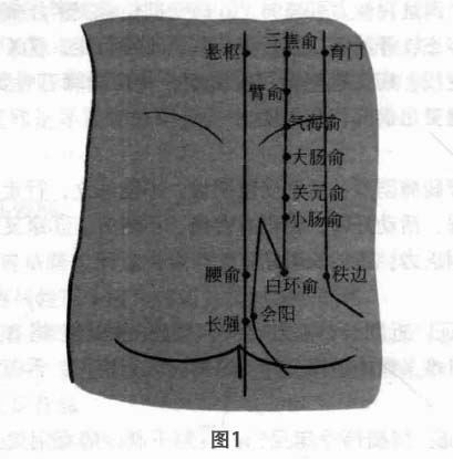 腰椎间盘突出症磁圆梅针疗法