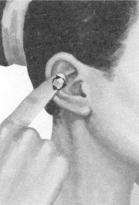 腰椎间盘突出症按摩部位图解