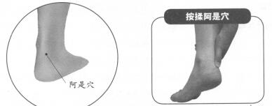 跟腱炎按摩部位图解