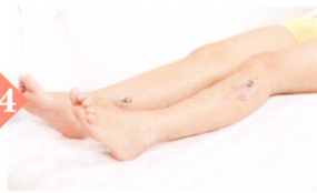 疲劳综合征拔罐部位图解