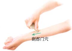 疖病-痈肿刮痧部位图解
