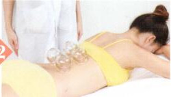 冻疮拔罐部位图解