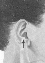 颈椎病按摩部位图解