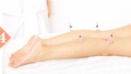 膝关节炎拔罐部位图解