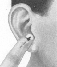 肩周炎按摩部位图解