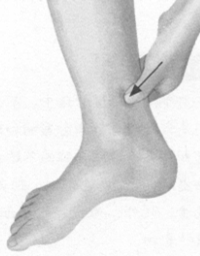 更年期综合征按摩部位图解