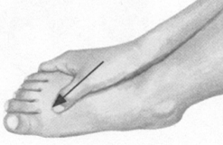 腹泻按摩部位图解