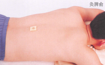 慢性胃炎艾灸哪个部位图解