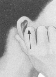 糖尿病按摩部位图解