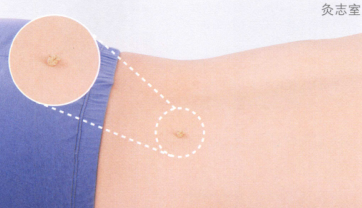 腰腿痛艾灸哪个部位图解