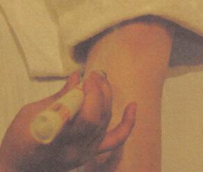 胃脘不适艾灸哪个部位图解