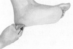 更年期综合征按摩部位图解