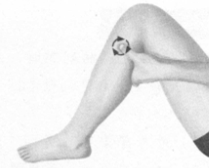 肩周炎按摩部位图解