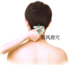 扭伤刮痧部位图解