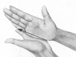 失眠症按摩部位图解