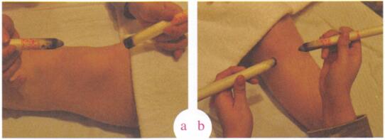 小儿生长关节痛艾灸哪个部位图解