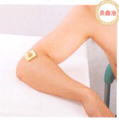 风湿性关节炎艾灸哪个部位图解