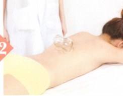 慢性胆囊炎拔罐部位图解