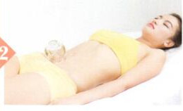 子宫脱垂拔罐部位图解